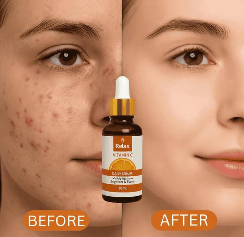 Brightening & Anti-Aging  Glow Serum / چمکدار جلد کا سیرم  || Relax Vitamin C